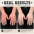 Load image into Gallery viewer, The Dry Skin Bundle

