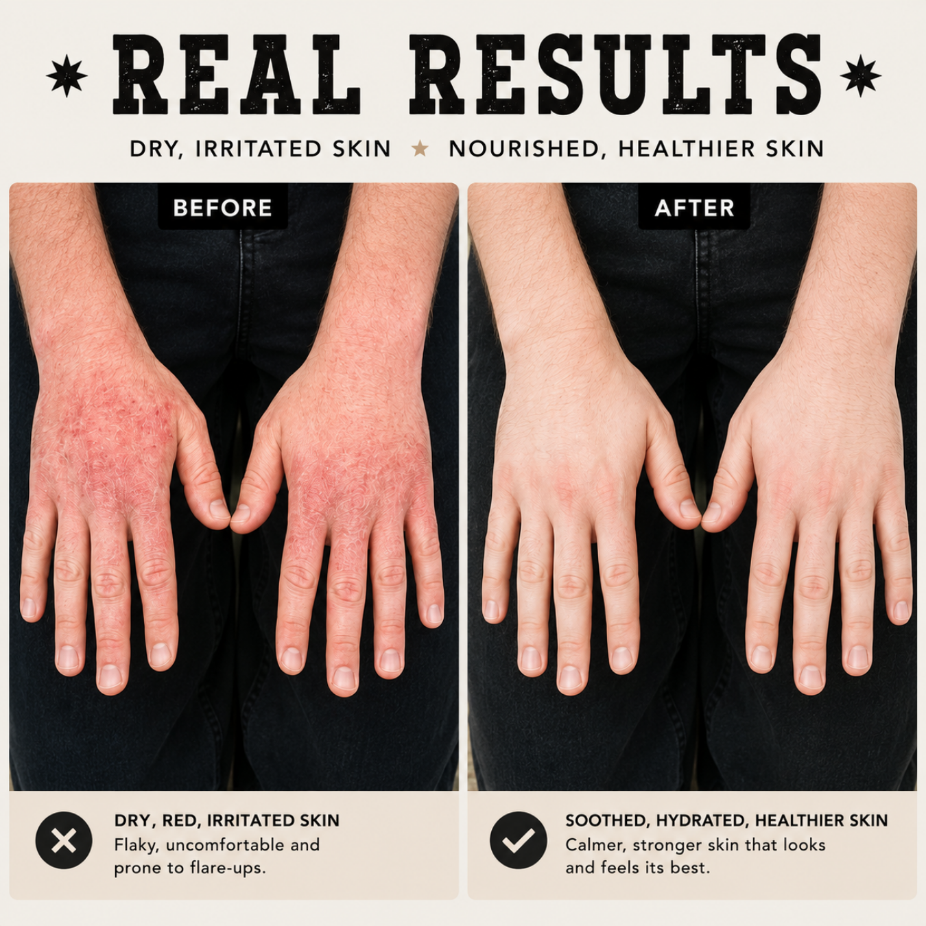 The Dry Skin Bundle