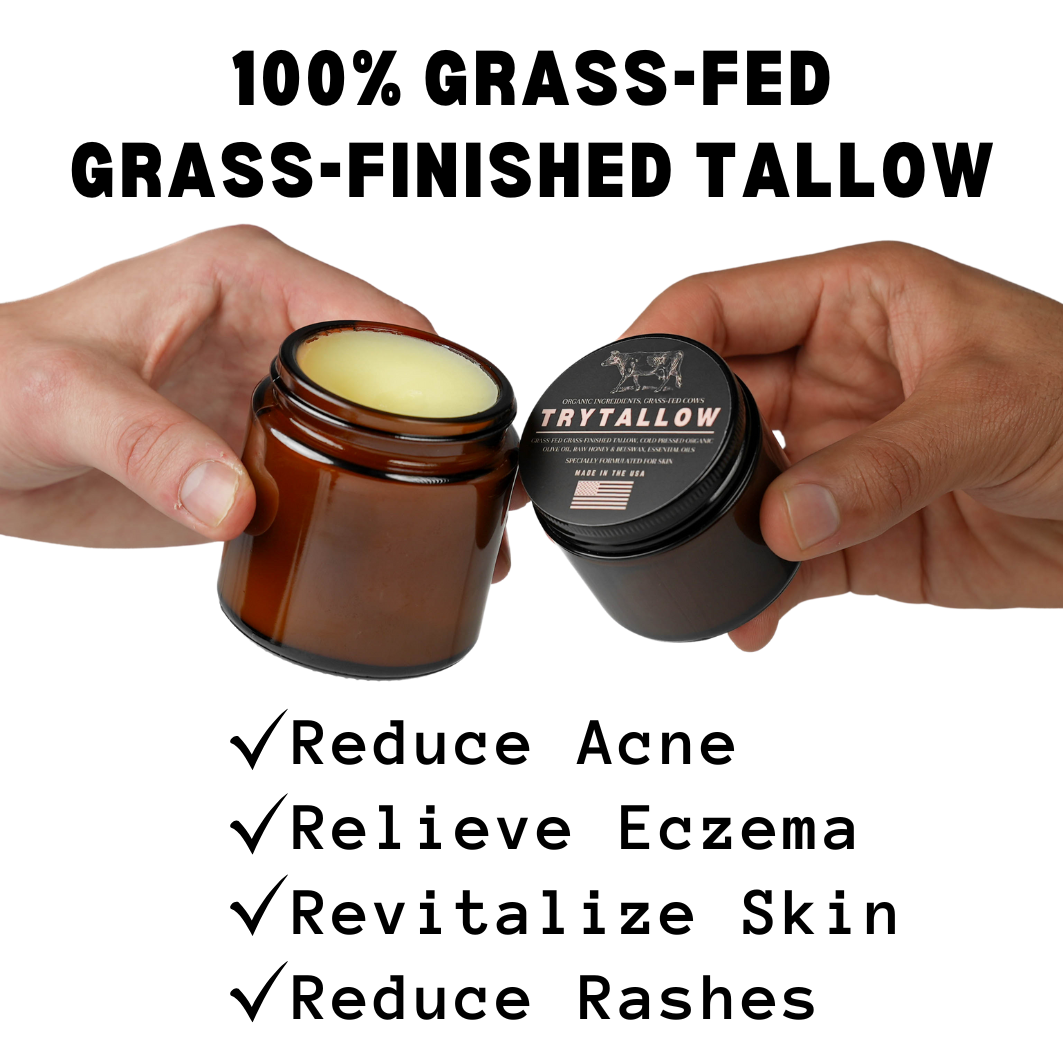 TryTallow™️ Wrinkle and Acne Fighting Tallow Balm 4oz